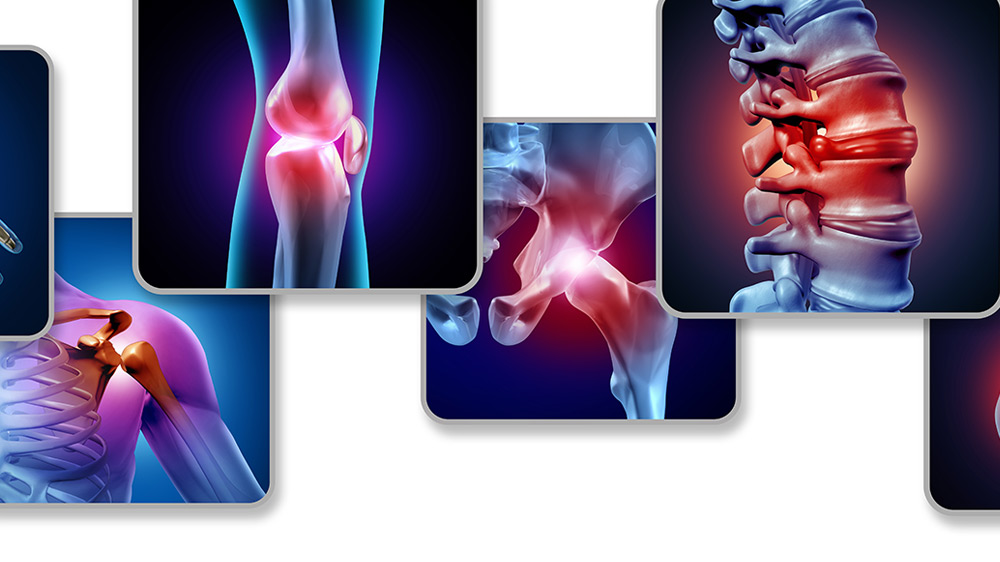 Muster in der Rheumatologie